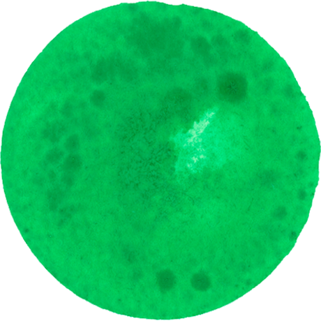 Dott-Gruen Dott-Gruen